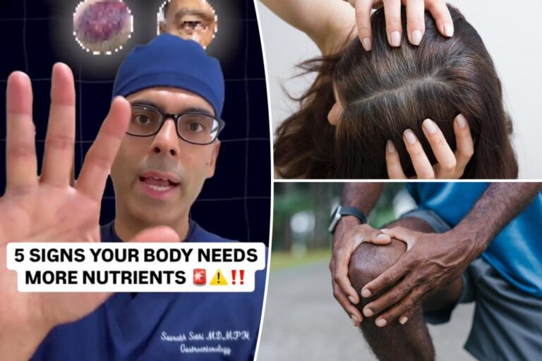 The doctor reveals 5 signs that your body needs more nutrients

