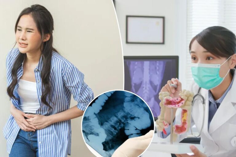 Rising rates of colorectal cancer in young adults: New concerns ID'd

